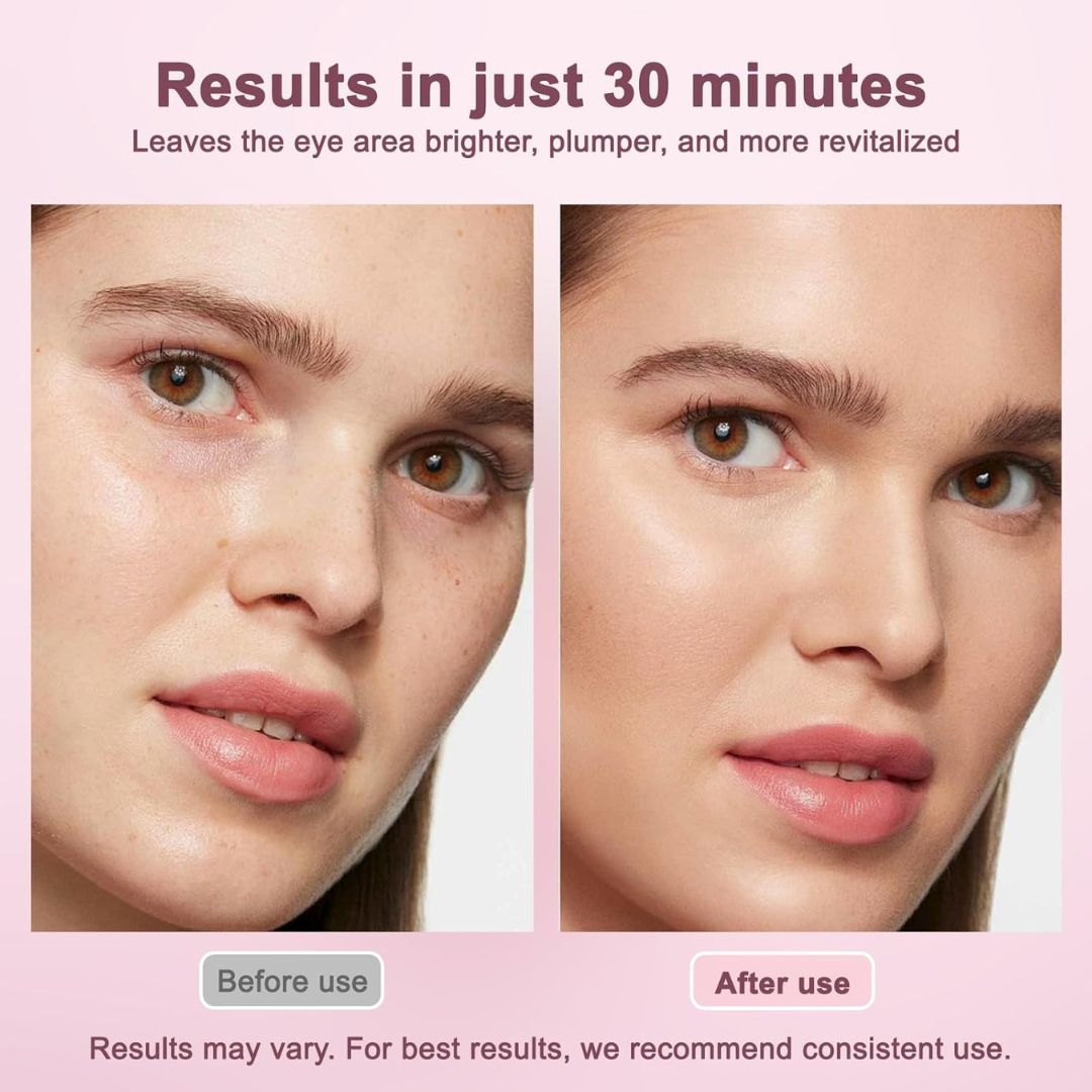 EyeDew™ Hydrating Care